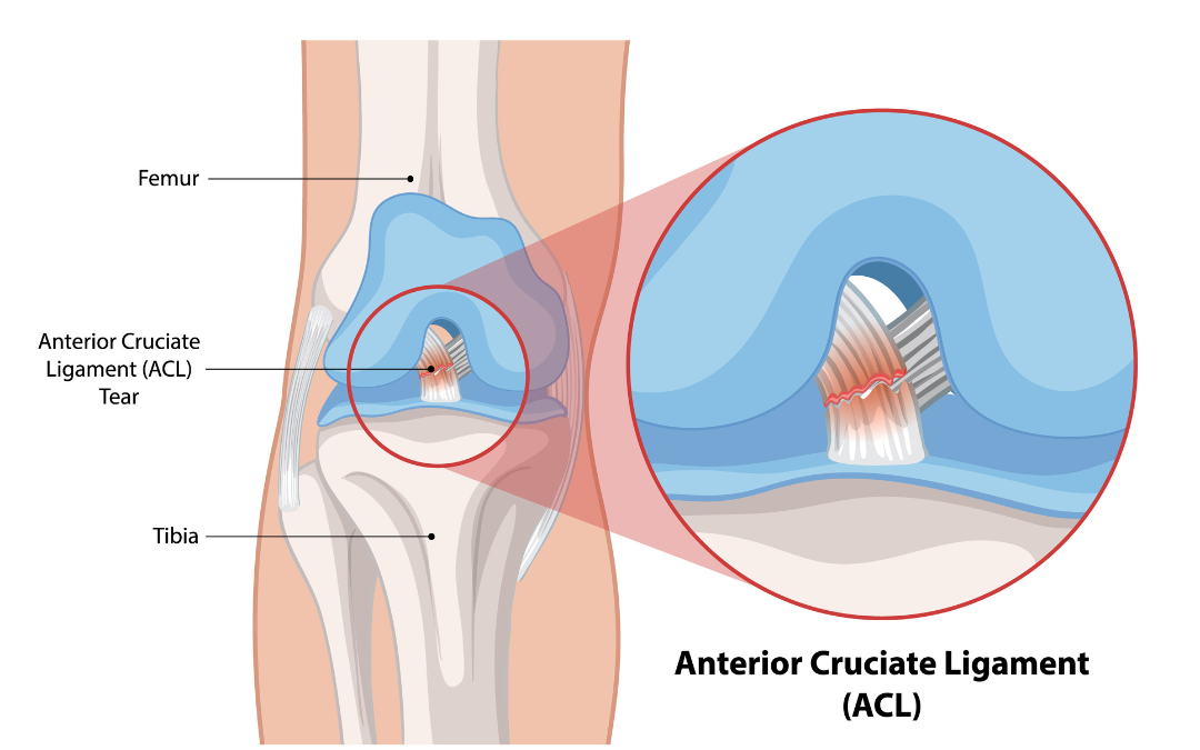 Knee Arthroscopy
