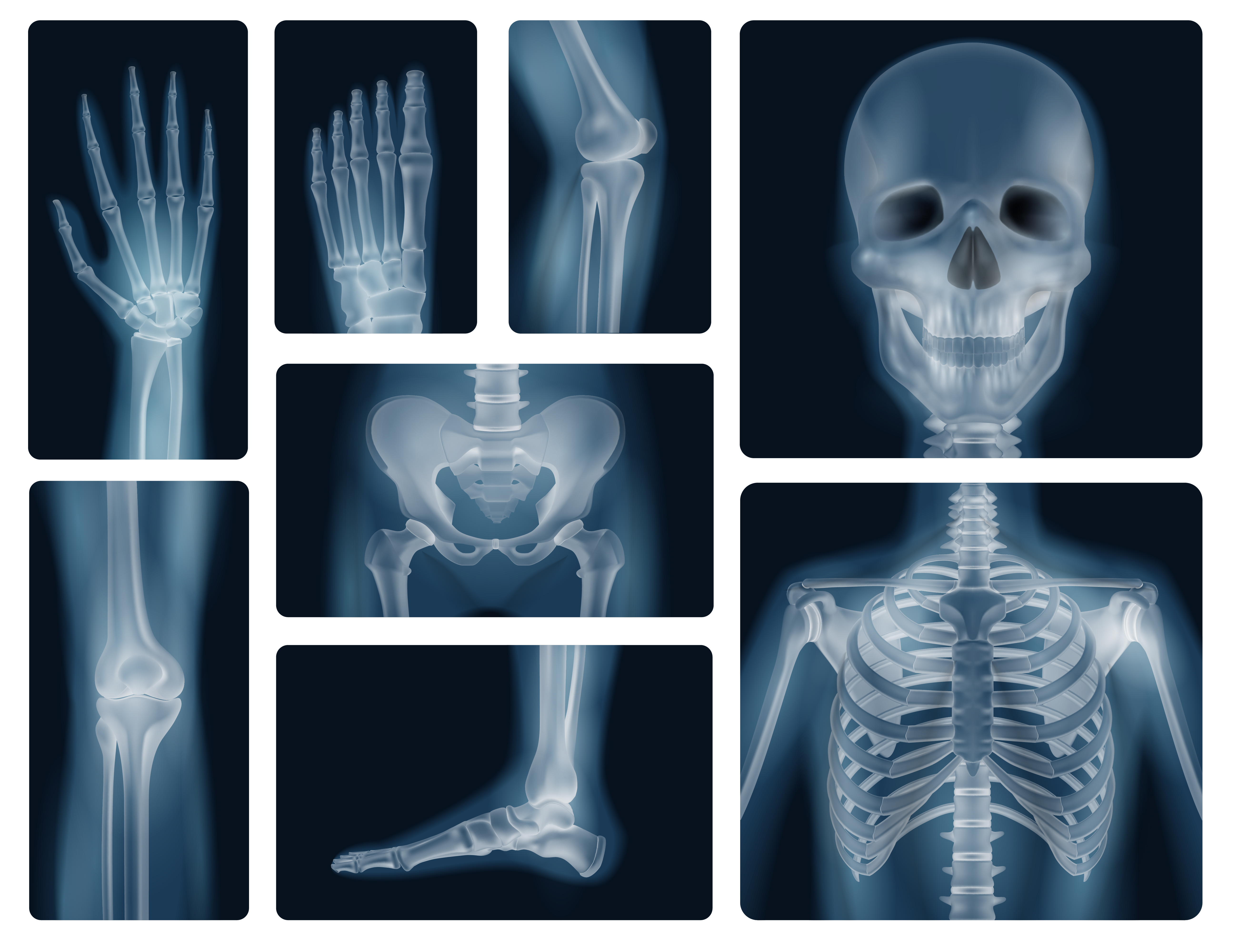 X-Ray Service
